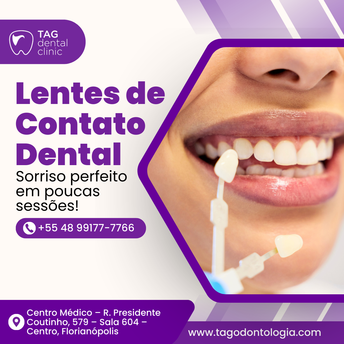lentes de contato dental
