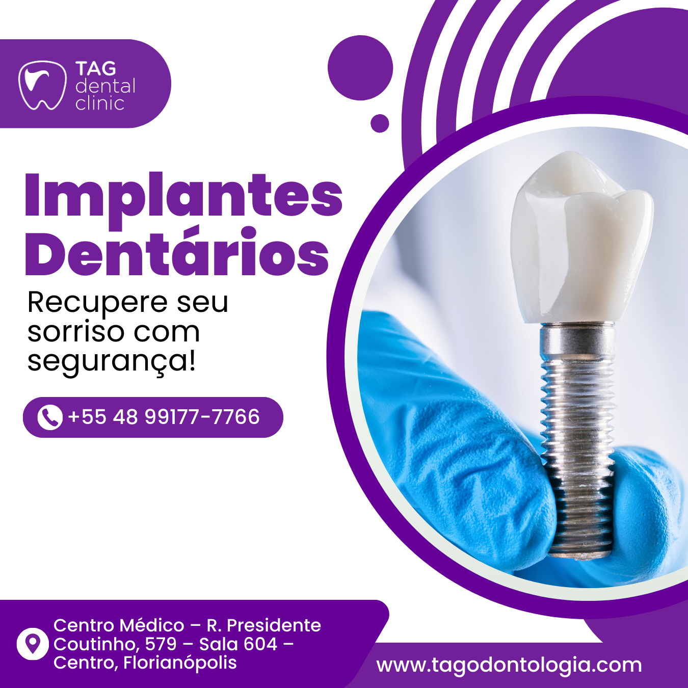Implantes Dentários em Florianópolis