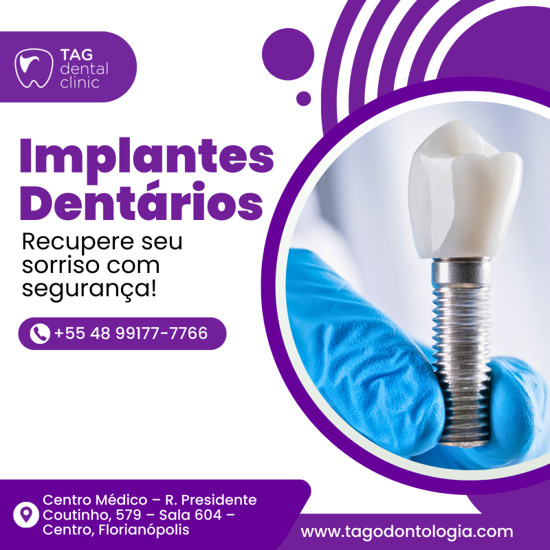 Implantes Dentários em Florianópolis Implantes Dentários em Florianópolis